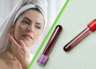 La ciencia acaba de descubrir cómo la sangre joven reactiva células para rejuvenecer la piel humana