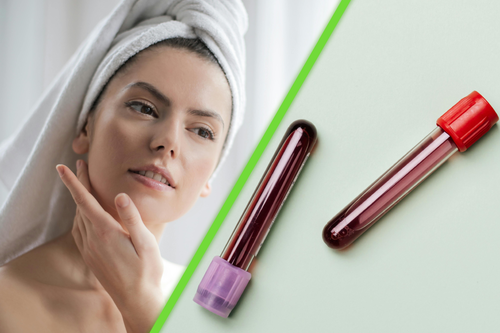 La ciencia acaba de descubrir cómo la sangre joven reactiva células para rejuvenecer la piel humana