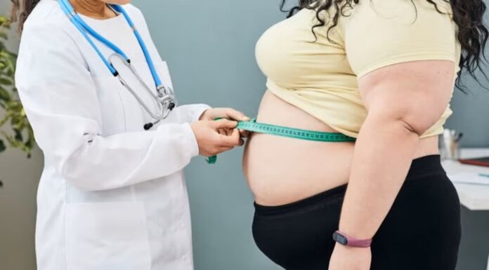 Obesidad, enfermedad crónica que requiere abordaje integral