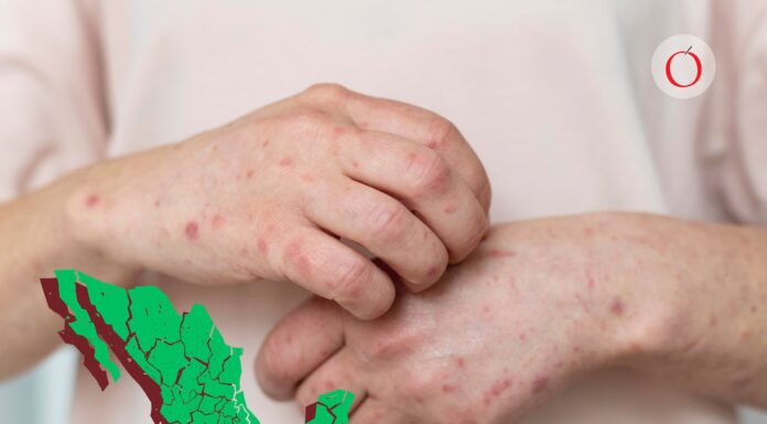 Ssa concentra vacunación contra sarampión en 11 estados, entre ellos la CDMX